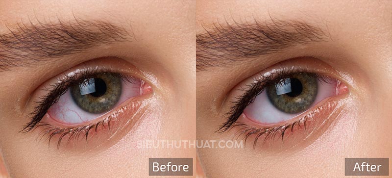 Retouch4me Eye Vessels