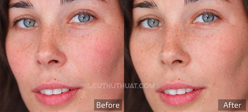 Retouch4me Skin Tone