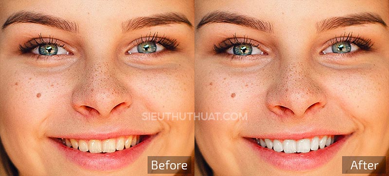 Retouch4me White Teeth